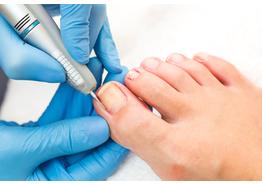 Podewelt - pedikűr - nitril kesztyű - Vigyázz Kéz Kesztyű